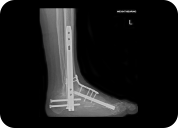 foot image